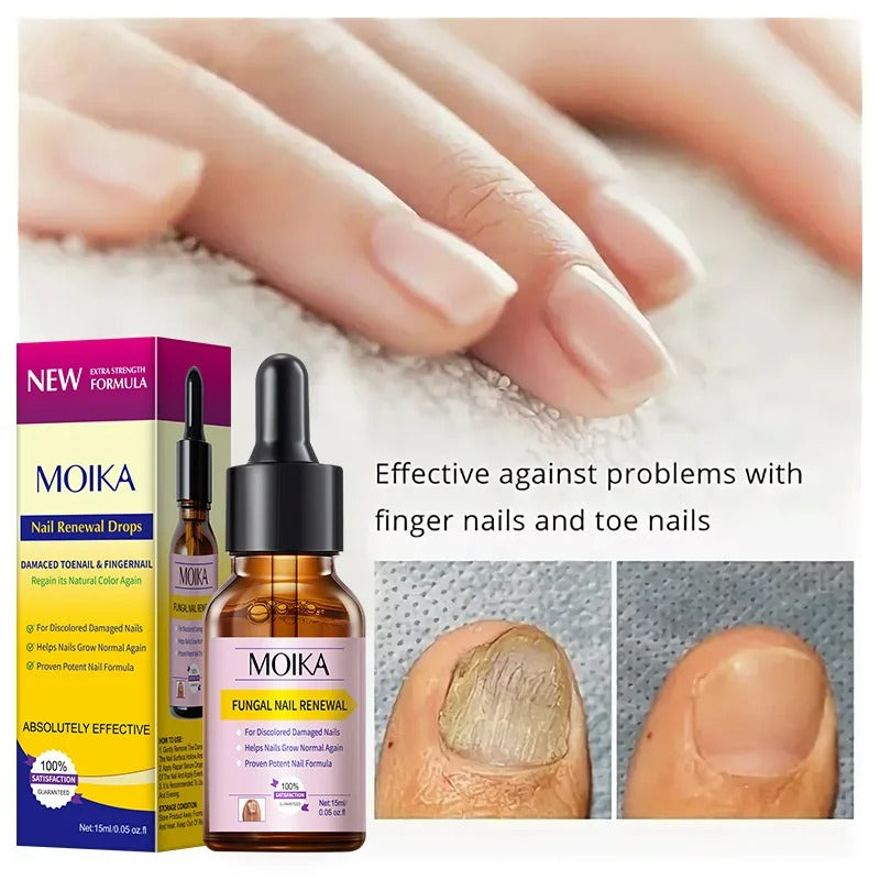 Nail fungus gel