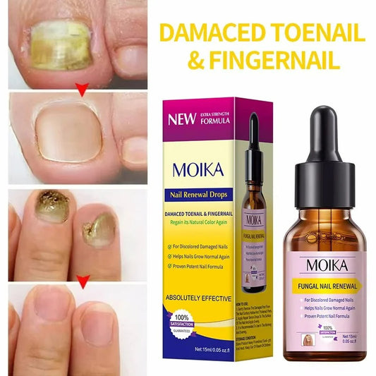Nail fungus gel